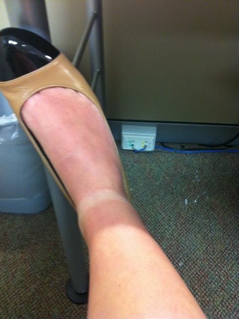 cttynan1's tweet image. This tan line is really killing my professional appearance. #pcbproblems
