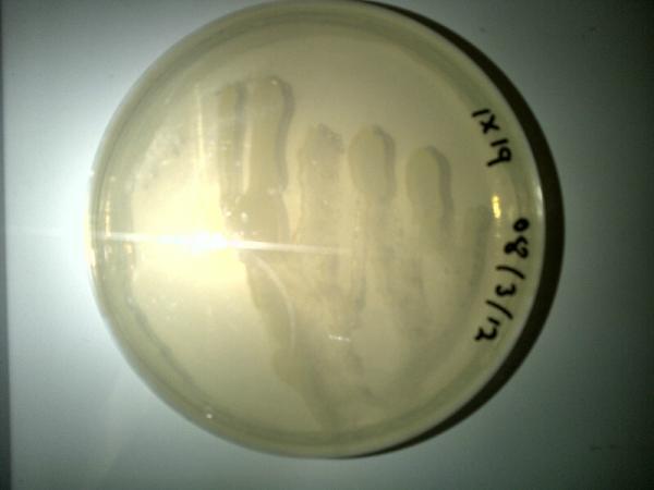 BiSN_Tech's tweet photo. Bacterial growth from a light oil formation stimulated under anaerobic conditions http://t.co/iP3HA139