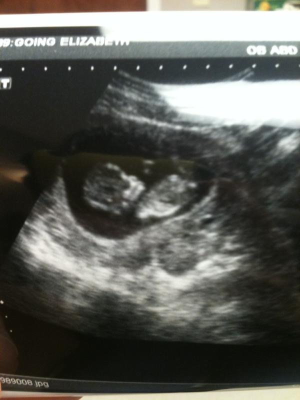 EllieGoing's tweet photo. There it is... My peanut. =) http://t.co/PpmhzAnY