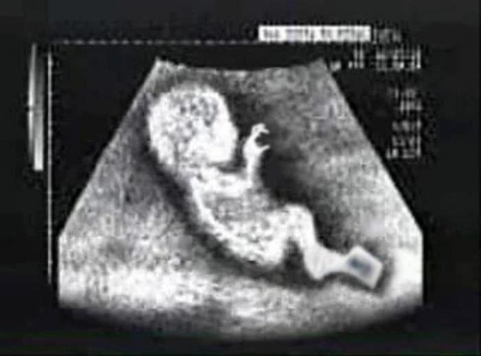 AphnI8HCAAAiTro?format=jpg&name=900x900