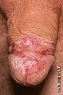 TheKevinWebster's tweet photo. this was what my cock looked like after i shafter Hayley Cropper. Dunno what @TheRoyCropper 's is like #FollowMeKev http://t.co/0MGvFTuz