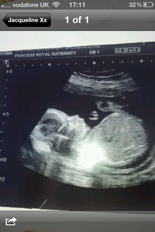 7_jj's tweet photo. Ma wee baby girl it 23 week=] http://t.co/PYO78B5B