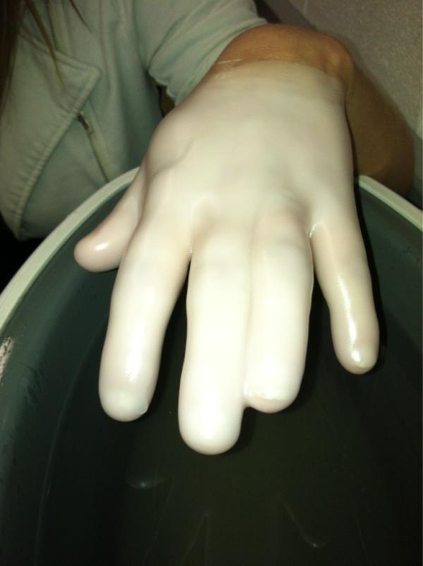 Lafegmeg's tweet image. When @alliebomba3 forgets to spread her fingers apart before putting them in wax. #kinesiologyproblems