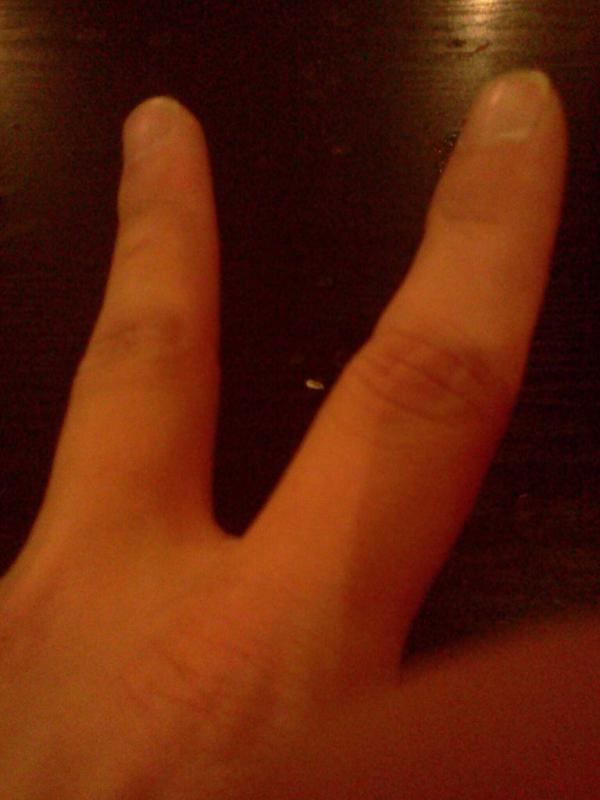 ElReyLucier's tweet image. #Peaxe