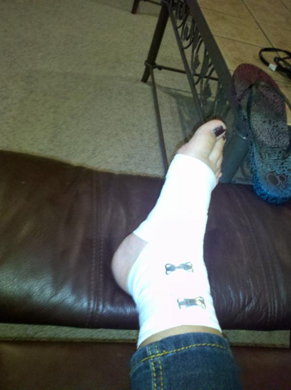 itsLoula's tweet image. Wahhh! :'( Yes, I will be the girl that's hobbling in the hallway! #SoNotFun