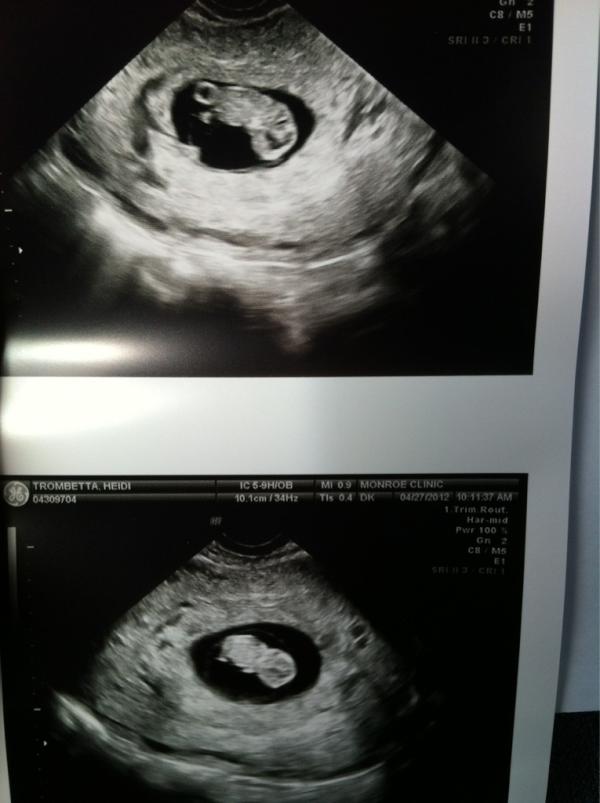 Htrombetta's tweet photo. Our little baby <3 9 weeks, due nov 30! http://t.co/e3YZfLyK
