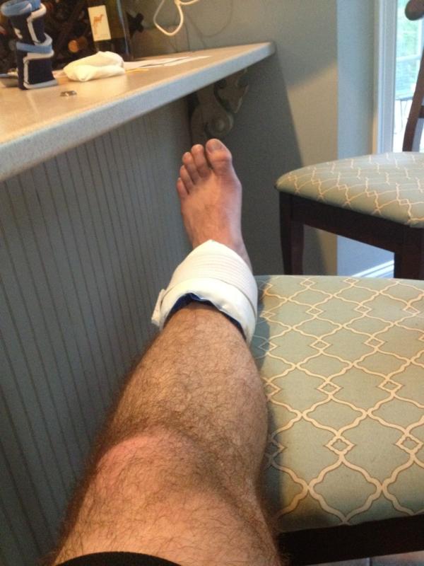 MikeyRich11's tweet image. Just icing the ankle after a rugged wiffleball game #summer2012 #sickstart @Corey_The_Cat