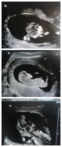 _BitchItsKB's tweet image. my baby #1 its hand #2its body #3it holdn its head ctfu my baby to funny .