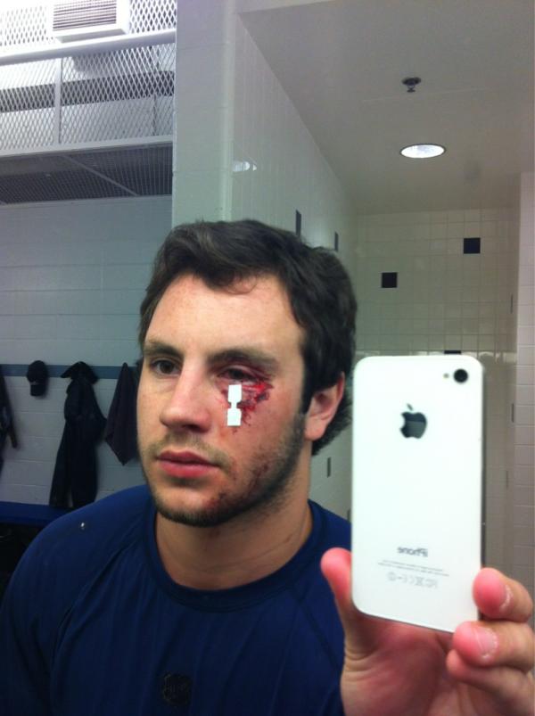 Markiw17's tweet image. Gotta love beer leagues #4thline4life #chicksdigscars