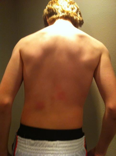 aidanhartwig's tweet photo. Sting pong, not the final outcome, they eventually puffed up and became white http://t.co/XXZhaUEr