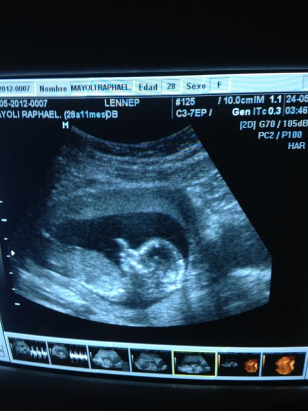 mikemen2a's tweet photo. les comparto la reciente foto de mi hija http://t.co/WudbfwI7