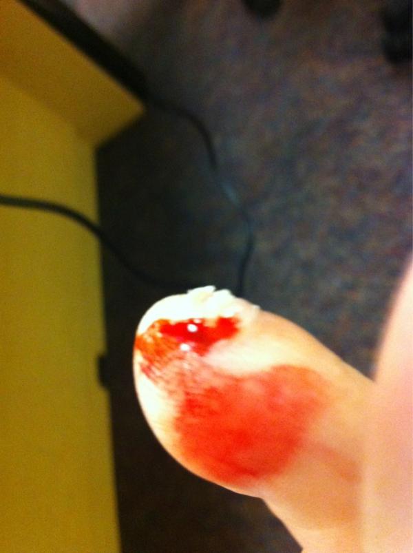 ryan farrell on twitter index toenail fell off this morning