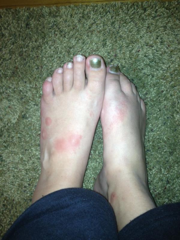 marinnfischer's tweet image. #CampingProblems