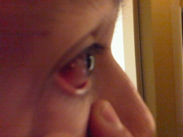 NoLore's tweet image. Mike performs a self exam. #selfresearcher #fcee12