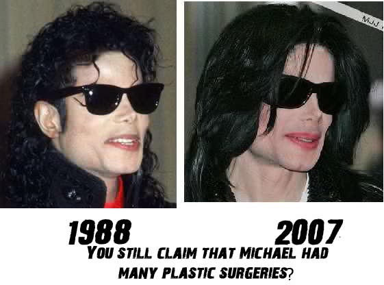 InvincibleMJ7's tweet image. Plastic surgery... your argument is invalid