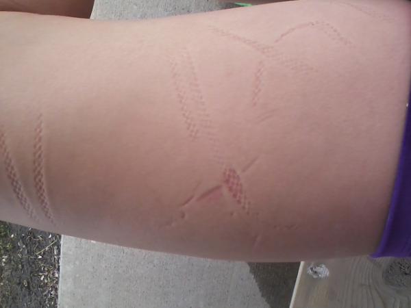 racheljelen's tweet image. @ilianabarrient1 @ashleybonk12 this is what i get for leaving my bag on my leg for a half hour #indents