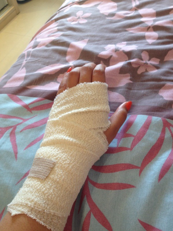 Naddooya's tweet image. Been having wrist pains.. Left side only.. Finally went to the GP.. He suspects carpel tunnel 😒 #morecrap