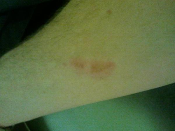 WheresWallyy's tweet image. @BaynhamJames still fucked #armupdate