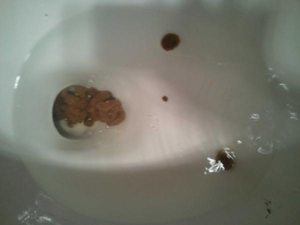 DailyDump3's tweet image. Poop spits #poopingproblems