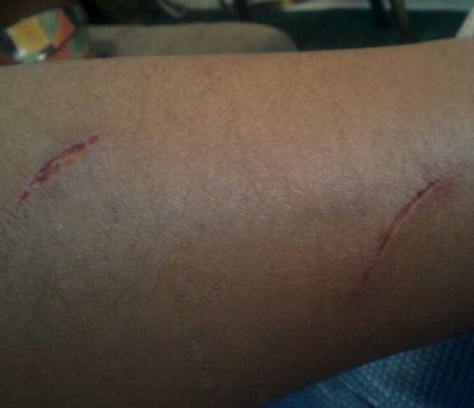 Ouch! http://t.co/17muUnah<a href="/tag/schwagg"class="tags"><span>#schwagg</span></a>