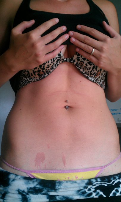 #dontcooknakad Bacon burn, I can't show the rest on Twitter. http://t.co/BpgljTJU<a href="/tag/dontcooknakad"class="tags">#dontcooknakad</a>