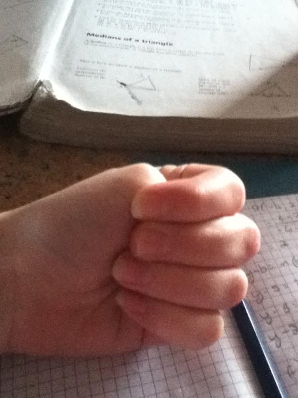 pudmuddy's tweet image. Thumbs up for amputees! #justdontfall