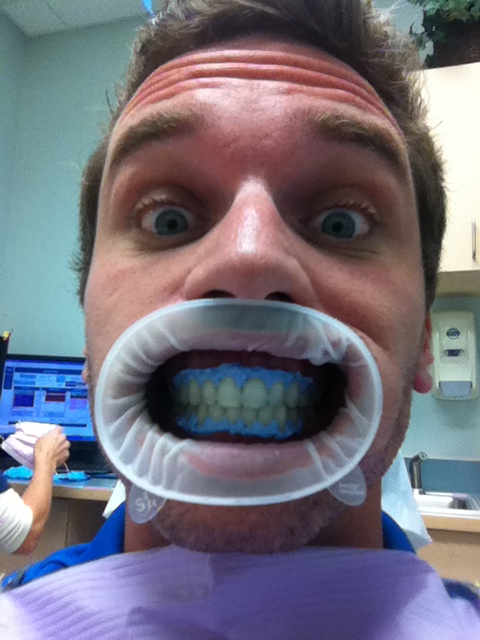 eboeh's tweet photo. Getting that whitening done. http://t.co/uxZ0CMSW