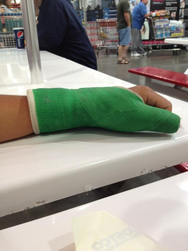 andyxoregon's tweet image. My friend @DevynMcCloud broke his thumb playing @ultiproblems and now we make fun of him constantly #ultimateproblems