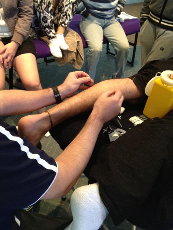 ActiveBodyRT's tweet image. Stewart Condie demonstrating how to needle the Gastrocs! Picture doesn't show it - but intense twitch response
