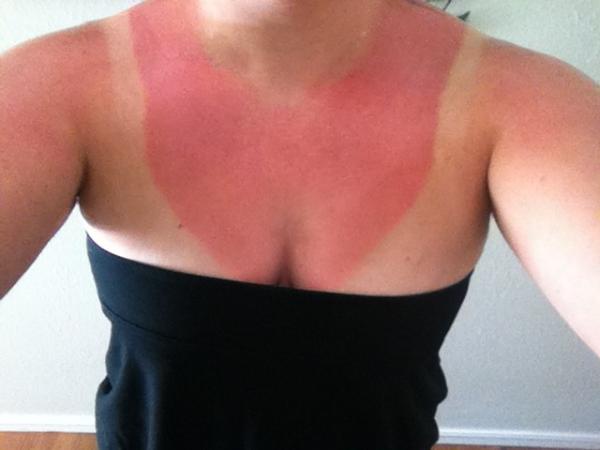 KaylaAnn524's tweet image. Not the way I wanted to spend my Monday #summerproblem