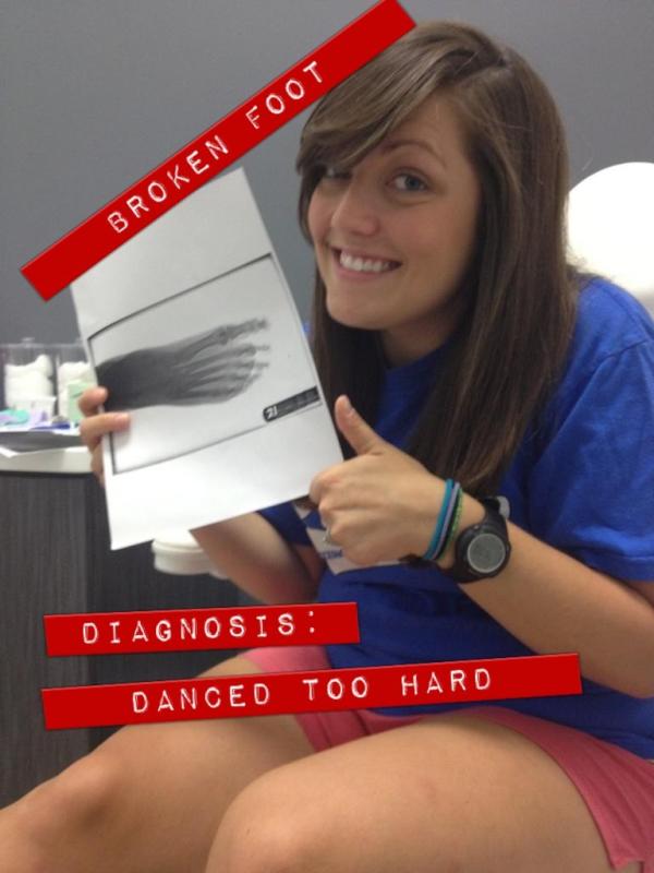 klopkekm's tweet image. The results are in! Broke my foot at Annie and Ross wedding this weekend #crazydancemove #outforthreeweeks