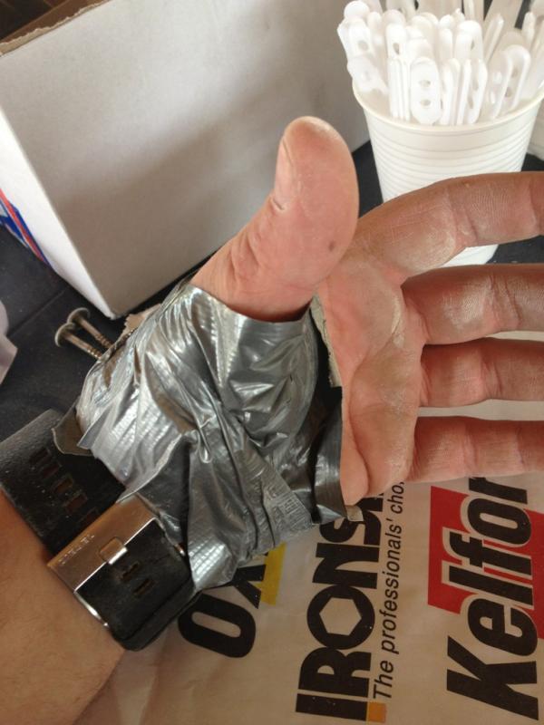 badboyGSI's tweet image. Levens gevaarlijk gewond en geen verbandtrommel :-{} de oplossing ducktape ;-)