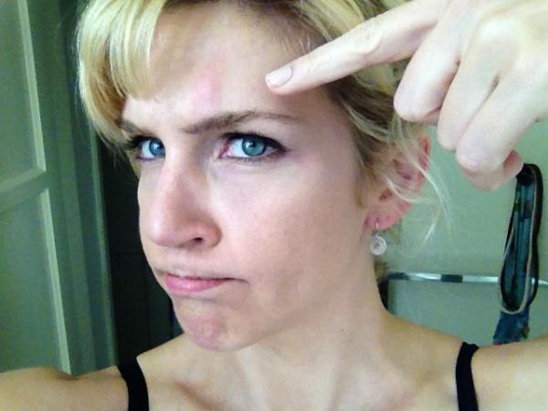 rheaseehorn's tweet photo. Oh my God-it's swelling--I am a dumbass. http://t.co/Ll7S0Atg