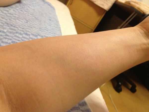 Tirol Su Twitter 我が家のプランター トマト きゅうり いんげんの収穫時期真っ最中 きゅうりは1本お猿が失敬して行ったとか 母からいんげんの収穫を頼まれたんだが アームカバーを忘れたのがまずかった かぶれて両腕赤まだら かゆいっ Http T