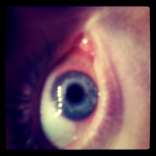 TimBolduc's tweet image. #contactproblems