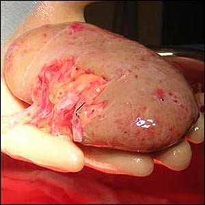 UMHcabreada's tweet photo. @UMH_ENERVADA ESTA CRIOGENIZADO LE DEJO UNA FOTO, A FALTA DE TRANSPLANTE. http://t.co/Ut4zOcqi