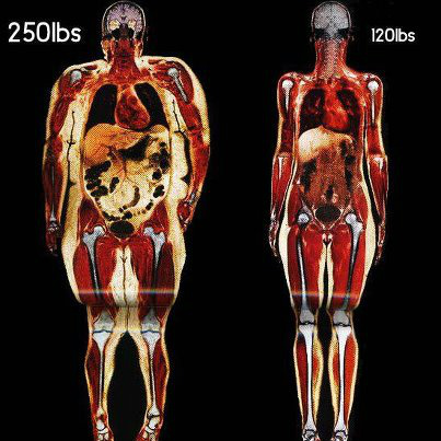 robvanntraining's tweet photo. The difference between being healthy &amp; lean and obese and really unhealthy! http://t.co/HMZOzBP0