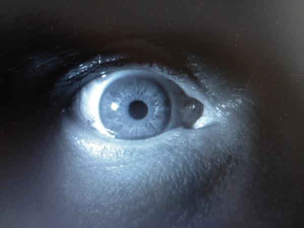 MGreenlarPhoto's tweet photo. Had corneal transplant surgery today. I have lay to lay flat on my back for 24 hours. http://t.co/KPSv6fZW
