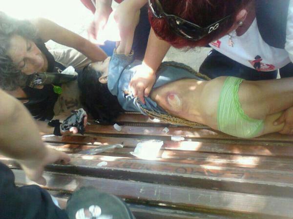 REDsistencia_'s tweet photo. Niña herida por pelota de goma en las cargas policiales de Madrid #marchaminera #recortes #congreso @ccifuentes http://t.co/95PEzQP2