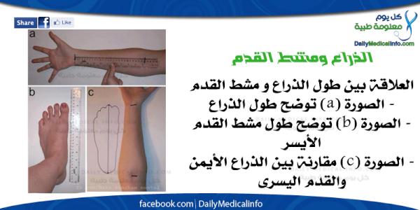 DMedicalinfo's tweet photo. #Study http://t.co/PseniTAN Foot and Forearm Comparison #USA #MD #PubMD #Health #Doctors #France #WebMD #Medical #DMI http://t.co/8xoWiUhl