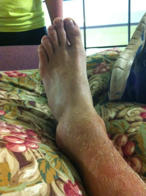 aaronwlsn's tweet image. Willoughby's super sprained ankle. #atldreamteam