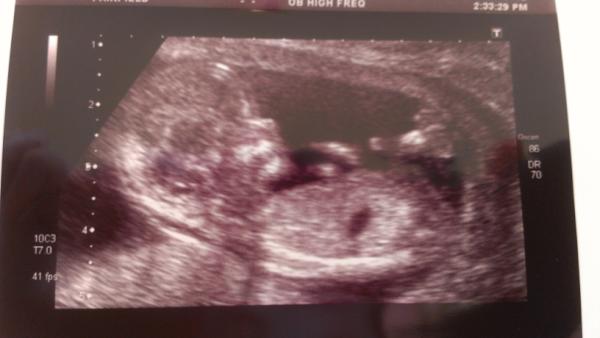 PhillipsDebbie's tweet photo. My little Niece or Nephew :-) xx http://t.co/B7sHEszo