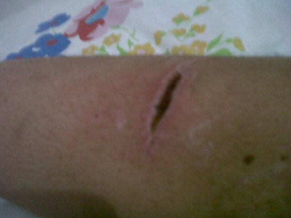 MarcoFernanda's tweet photo. La mordida http://t.co/cGNegT61