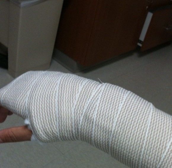 Landonwolfeswag's tweet image. #brokearm #baseballprobz