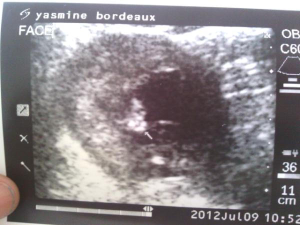YasmineSemone's tweet photo. Ready for my baby to come January hurry up http://t.co/DzHh5tBM