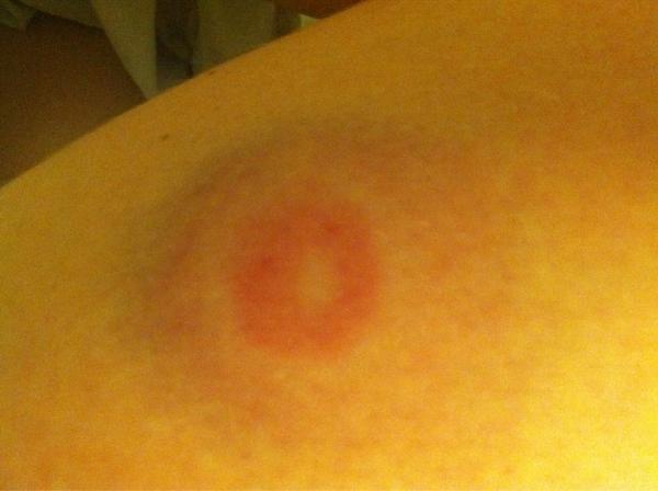 lindseyaslack's tweet image. Paint ball after math. #ouch #firstoneout
