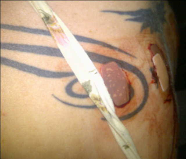 Battle wounds!!!! More pics to follow! http://t.co/06eY3upI<a href="/tag/suspension"class="tags"><span>#suspension</span></a>