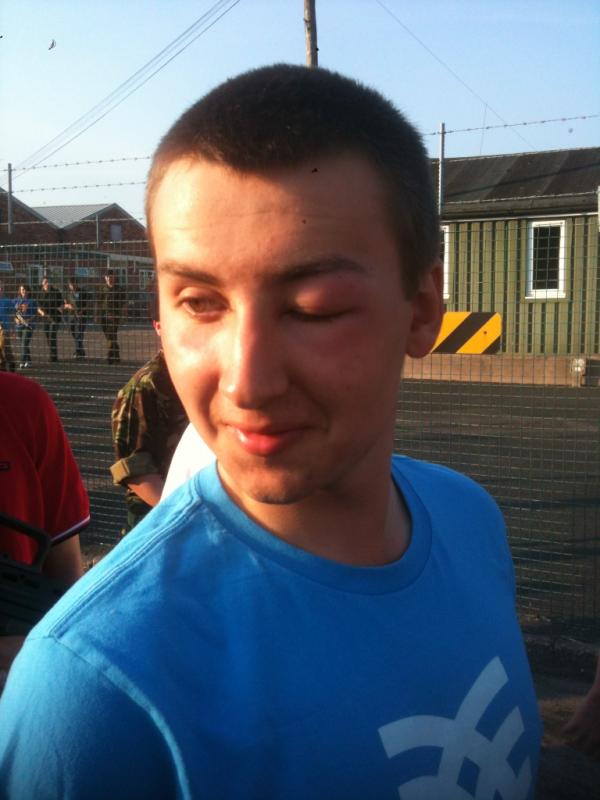 ExeterRMC's tweet image. Battle wounds sustained while in the field!