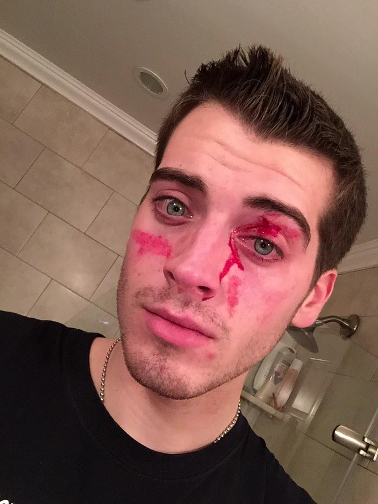 Jackcussen24's tweet image. Did I really just run into a car! Wow #bleedingred