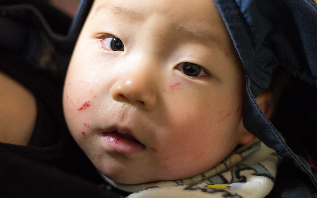 パパやる 生後10ヶ月 保育園で顔じゅう傷だらけ 爪はしっかり切ってあげましょう Http T Co Mole4arlss あごから眉の上まで30ヶ所ほどの小傷が Http T Co Iogoh9adaf